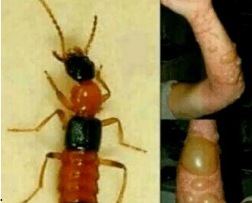 昆虫皮肤动作爆料视频教程,跟随视频教程探索昆虫皮肤奥秘